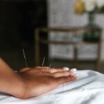 Les bonnes raisons de faire appel à un acupuncteur